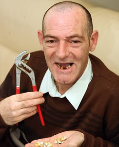 13teeth.jpg